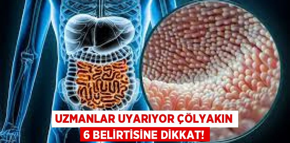 UZMANLAR UYARIYOR ÇÖLYAKIN 6 BELİRTİSİNE DİKKAT!