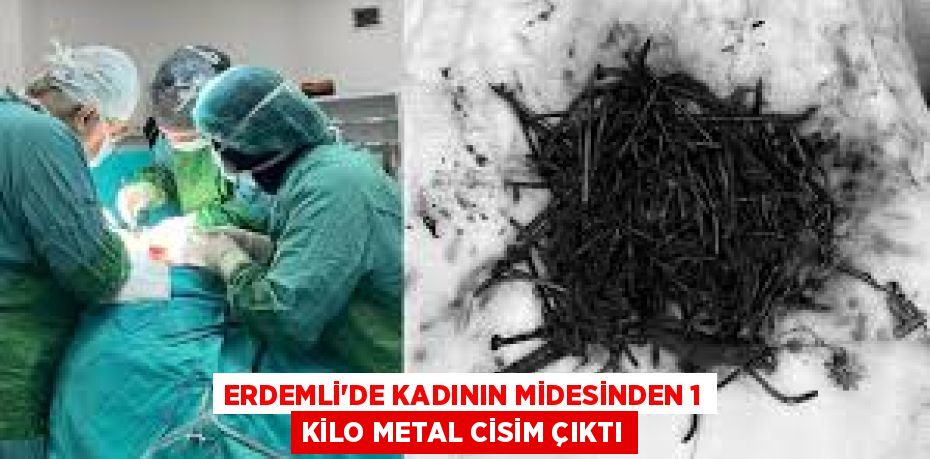 ERDEMLİ’DE KADININ MİDESİNDEN 1 KİLO METAL CİSİM ÇIKTI
