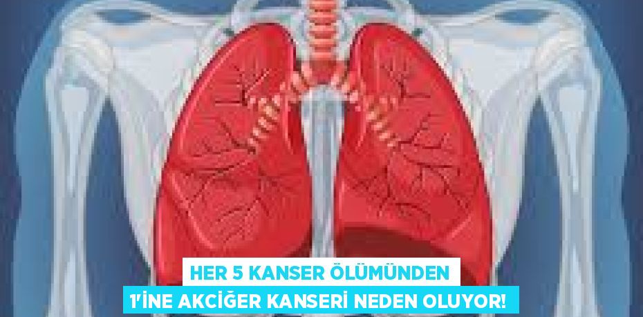 HER 5 KANSER ÖLÜMÜNDEN 1’İNE AKCİĞER KANSERİ NEDEN OLUYOR!